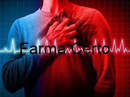 Arritmias Cardíacas